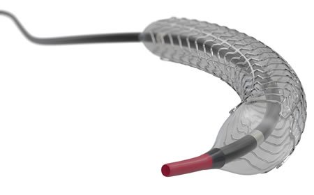 CORNERY STENT TANSAIN - Image 3