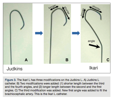 GUIDING CATHETER EKARI - Image 3
